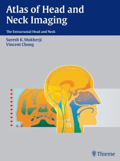 Cover Atlas of Head and Neck Imaging (eBook, PDF)