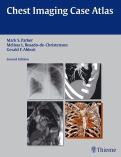 Chest Imaging Case Atlas (eBook, PDF) - Parker, Mark S.; Rosado-De-Christenson, Melissa L.; Abbott, Gerald F.