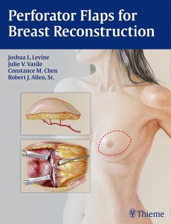 Cover Perforator Flaps for Breast Reconstruction (eBook, PDF)