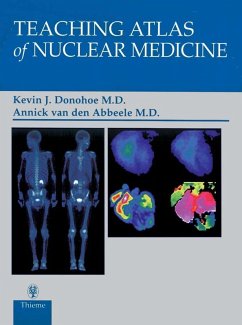 Teaching Atlas of Nuclear Medicine (eBook, ePUB) - Donohoe, Kevin J.; Abbeele, Annick van den