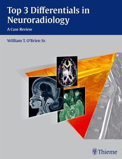 Top 3 Differentials in Neuroradiology (eBook, PDF) - O'Brien, William T.