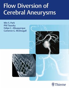 Flow Diversion of Cerebral Aneurysms (eBook, PDF) - Park, Min S.; Taussky, Phil; Albuquerque, Felipe C.; Mcdougall, Cameron G.