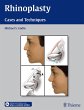 Rhinoplasty (eBook, PDF) - Bild 1