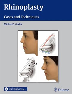 Rhinoplasty (eBook, PDF) - Godin, Michael S.