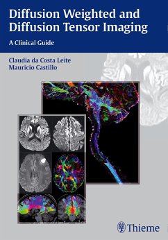 Diffusion Weighted and Diffusion Tensor Imaging (eBook, PDF)