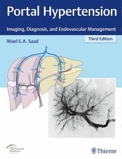 Portal Hypertension (eBook, PDF) - Saad, Wael E.A.