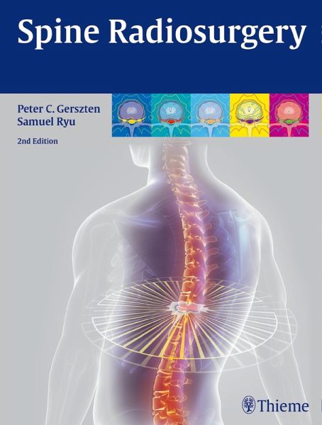 Spine Radiosurgery (eBook, PDF)