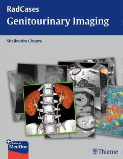 Radcases Genitourinary Imaging (eBook, PDF) - Chopra, Shailendra