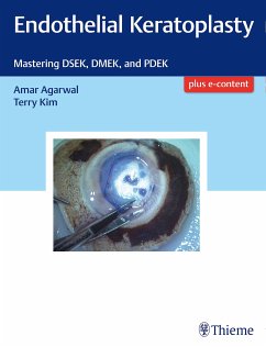 Endothelial Keratoplasty (eBook, PDF) - Agarwal, Amar; Kim, Terry