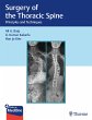 Surgery of the Thoracic Spine (eBook,... - Bild 1