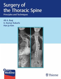 Surgery of the Thoracic Spine (eBook, PDF) - Baaj, Ali A.; Kakarla, U. Kumar; Kim, Han Jo