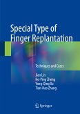 Special Type of Finger Replantation (eBook, PDF)