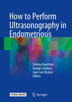 How to Perform Ultrasonography in Endometriosis (eBook, PDF)
