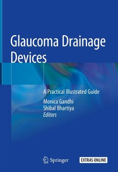 Cover Glaucoma Drainage Devices (eBook, PDF)