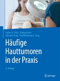 Häufige Hauttumoren in der Praxis (eBook, PDF)