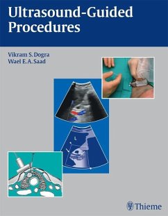 Ultrasound-Guided Procedures (eBook, ePUB) - Dogra, Vikram S.; Saad, Wael E. A.
