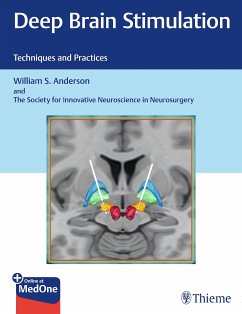 Deep Brain Stimulation (eBook, PDF) - Anderson, William S.; The Society for Innovative Neuroscience