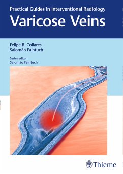 Varicose Veins (eBook, PDF) - Collares, Felipe; Faintuch, Salomao