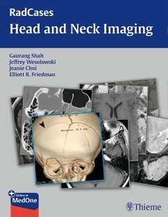 RadCases Head and Neck Imaging (eBook, PDF)