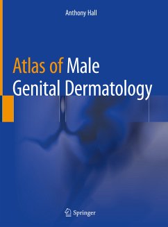 Atlas of Male Genital Dermatology (eBook, PDF) - Hall, Anthony