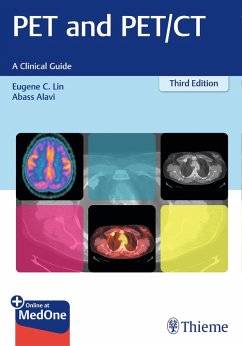 PET and PET/CT (eBook, PDF) - Lin, Eugene C.; Alavi, Abass