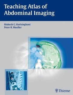 Teaching Atlas of Abdominal Imaging (eBook, PDF) - Harisinghani, Mukesh G.; Mueller, Peter R.