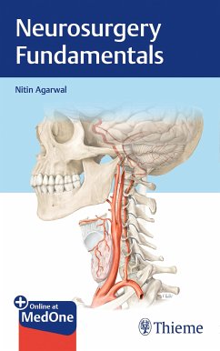 Neurosurgery Fundamentals (eBook, PDF) - Agarwal, Nitin