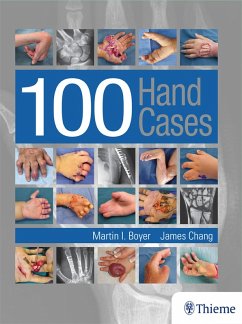 100 Hand Cases (eBook, PDF) - Boyer, Martin; Chang, James