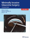 Minimally Invasive Glaucoma Surgery (eBook, PDF)