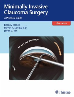 Minimally Invasive Glaucoma Surgery (eBook, PDF) - Francis, Brian; Sarkisian, Steven; Tan, James C.