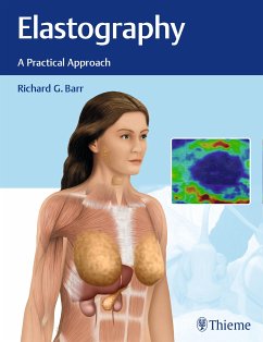 Elastography (eBook, PDF) - Barr, Richard G.