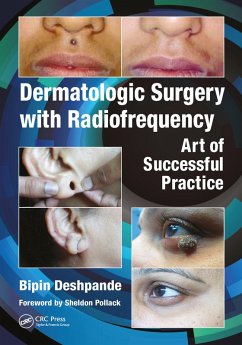 Dermatologic Surgery with Radiofrequency (eBook, PDF) Cover Dermatologic Surgery with Radiofrequency (eBook, PDF)