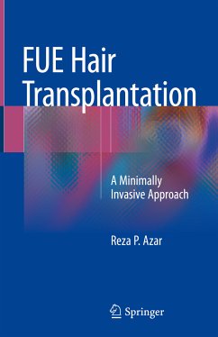 FUE Hair Transplantation (eBook, PDF) - Azar, Reza P.