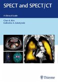 SPECT and SPECT/CT (eBook, PDF)