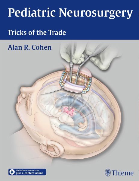 Pediatric　von　Neurosurgery:　bei　Tricks　of　Alan　the　Trade　(eBook,　ePUB)　R.　Cohen　Portofrei
