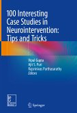 100 Interesting Case Studies in Neurointervention: Tips and Tricks (eBook, PDF)