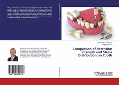 Comparison of Retention Strength and Stress Distribution on Tooth