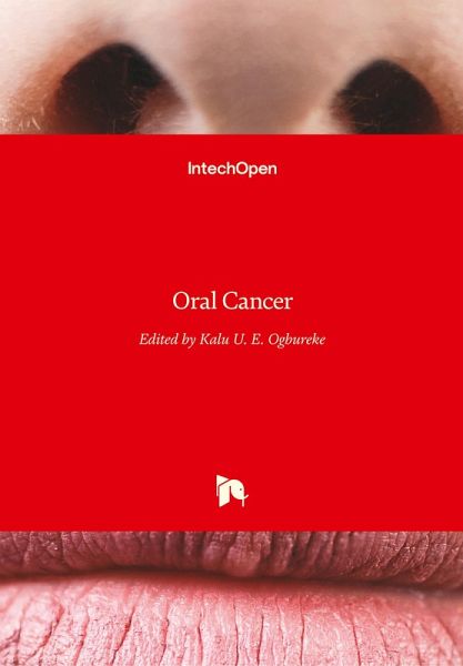 Oral Cancer Oral Cancer