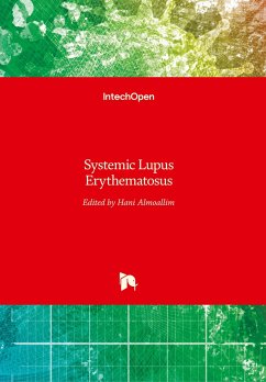 Systemic Lupus Erythematosus