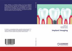 Implant Imaging - E. K., Fasla;Chatra, Laxmikanth;Shenoy, Prashanth