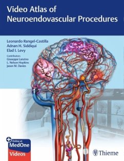 Video Atlas of Neuroendovascular Procedures - Siddiqui, Adnan H.;Levy, Elad I.;Lanzino, Giuseppe
