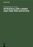 Intraokulare Linsen und ihre Implantation (eBook, PDF)
