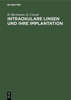 Intraokulare Linsen und ihre Implantation (eBook, PDF) - Bleckmann, H.; Conrad, R.