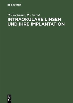 Cover Intraokulare Linsen und ihre Implantation (eBook, PDF)