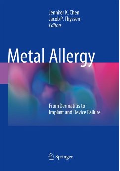 Metal Allergy