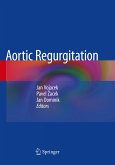 Aortic Regurgitation