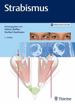 Strabismus