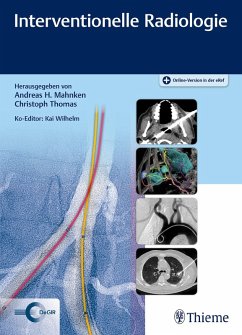 Interventionelle Radiologie (eBook, PDF)