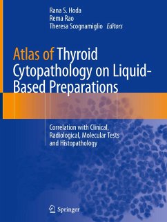 Atlas of Thyroid Cytopathology on Liquid-Based Preparations