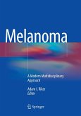 Melanoma